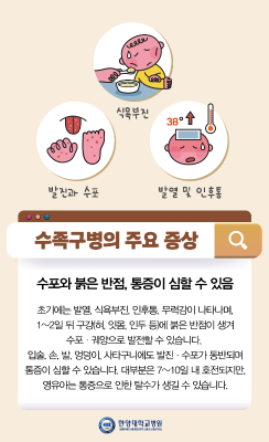 선선해지는 날씨, 우리 아이 비상! '수족구병' 예방법은?
